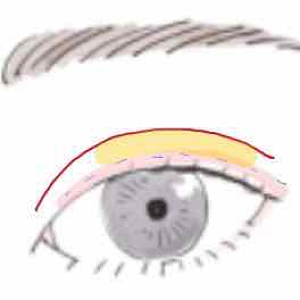 アイビューティー フィクサー WP/アストレア ヴィルゴ/二重まぶた用アイテムを使ったクチコミ(2枚目)