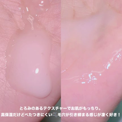 毛穴アンプル/ブラン/美容液を使ったクチコミ(3枚目)