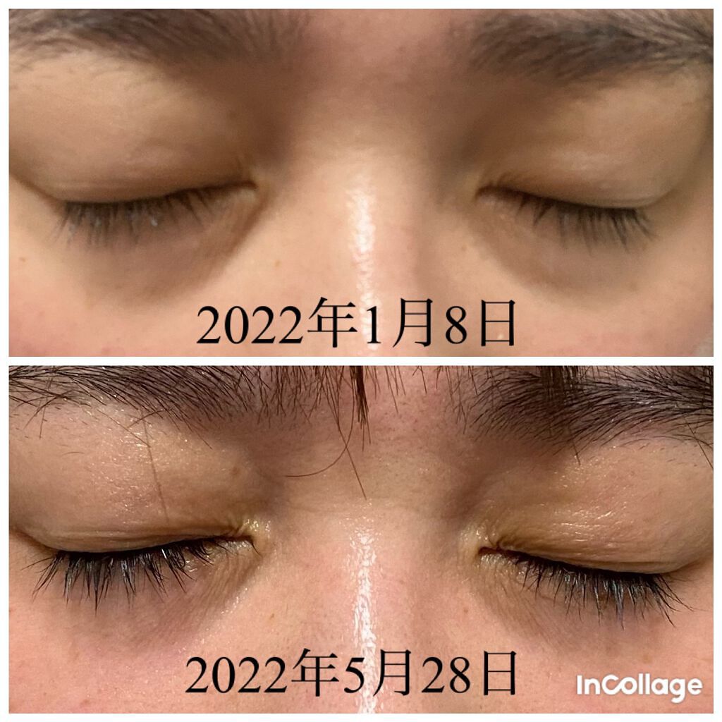 EMAKED(エマーキット)/水橋保寿堂製薬/まつげ美容液を使ったクチコミ(2枚目)