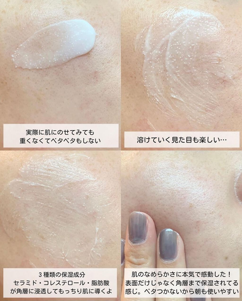 アトバリア365クリーム/AESTURA/フェイスクリームを使ったクチコミ(5枚目)