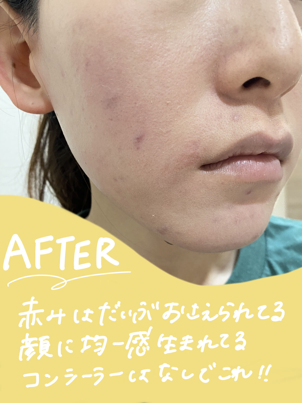 クリアラスト フェイスパウダー N 薬用オークル/クリアラスト/プレストパウダーを使ったクチコミ（3枚目）