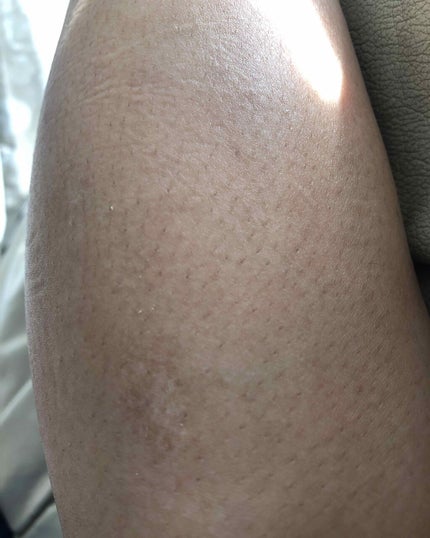 を使ったクチコミ(1枚目)