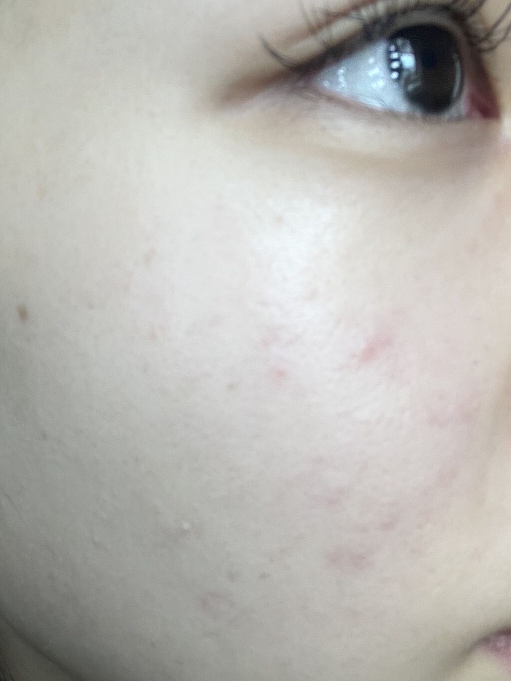 フィットミー コンシーラー/MAYBELLINE NEW YORK/リキッドコンシーラーを使ったクチコミ（3枚目）