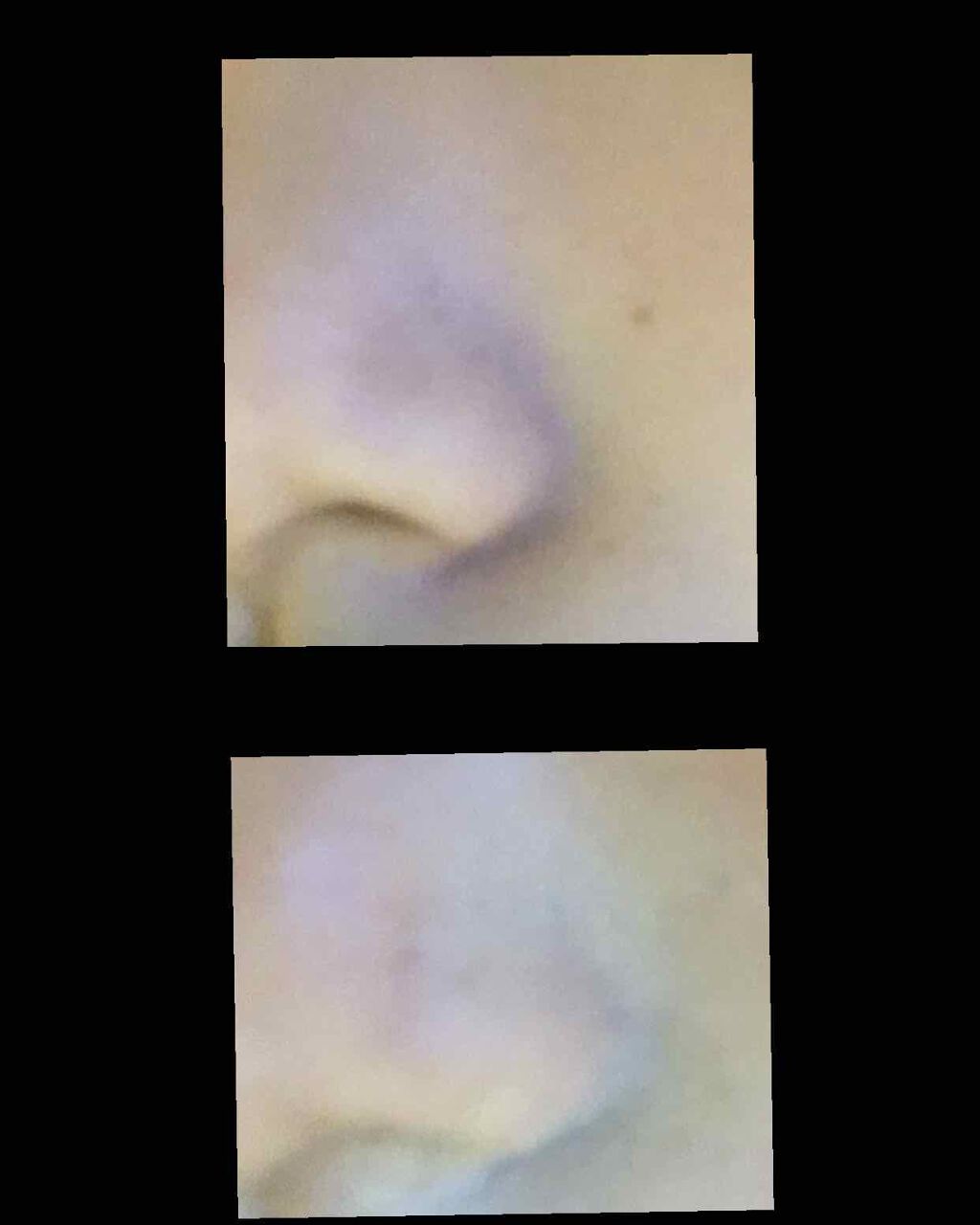 ザ コンシーラー AKAMI グリーンベージュ/MISSHA/リキッドコンシーラーを使ったクチコミ（2枚目）