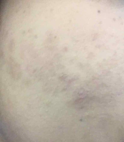 すっぴんパウダー B サクラスウィートソローの香り 2022/クラブ/プレストパウダーを使ったクチコミ(4枚目)