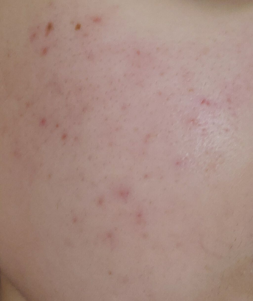 ハトムギ化粧水(ナチュリエ スキンコンディショナー R )/ナチュリエ/化粧水を使ったクチコミ(3枚目)