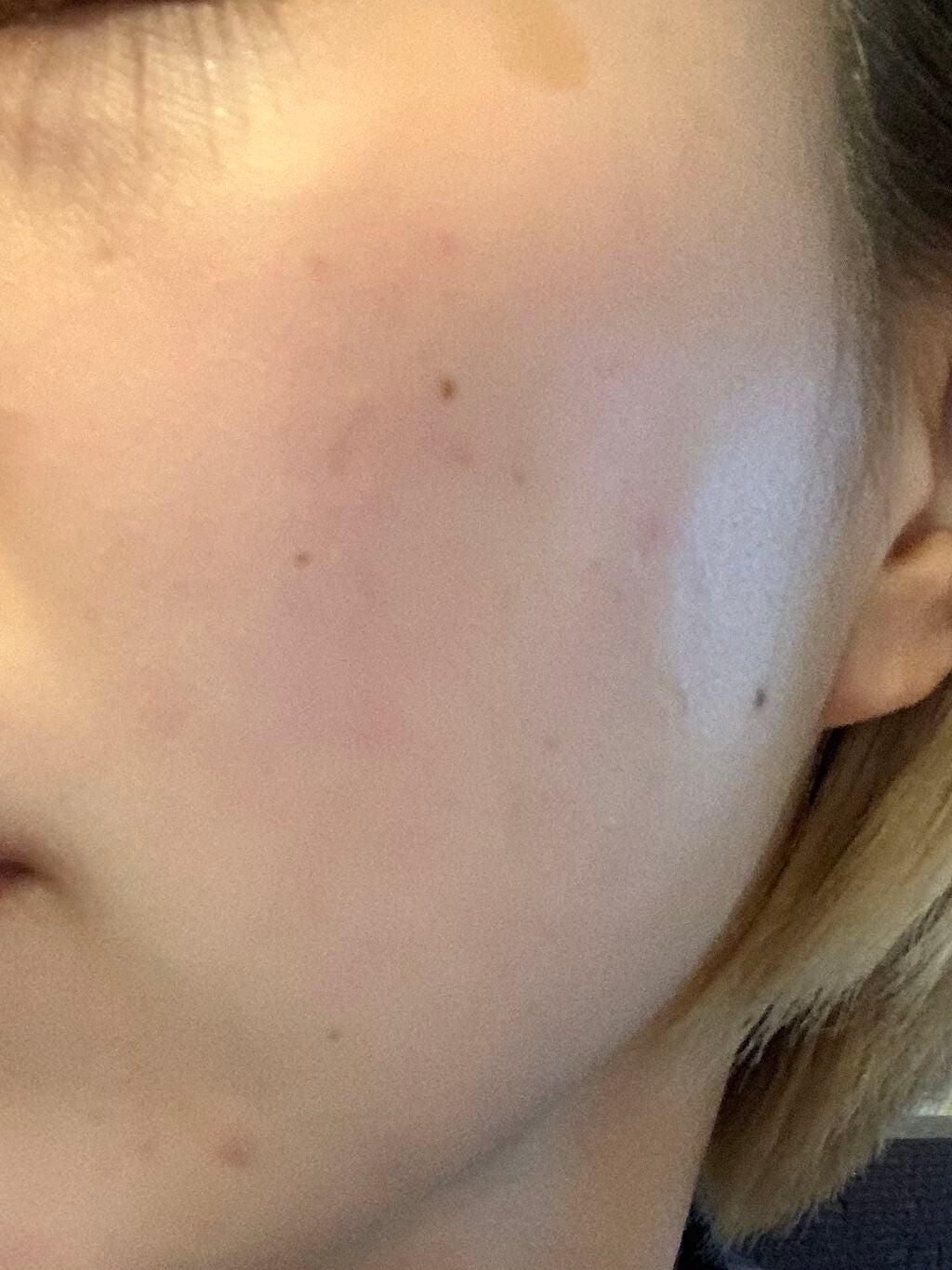 ピアソンHPローション(医薬品)/ピアソンHP/その他を使ったクチコミ(2枚目)