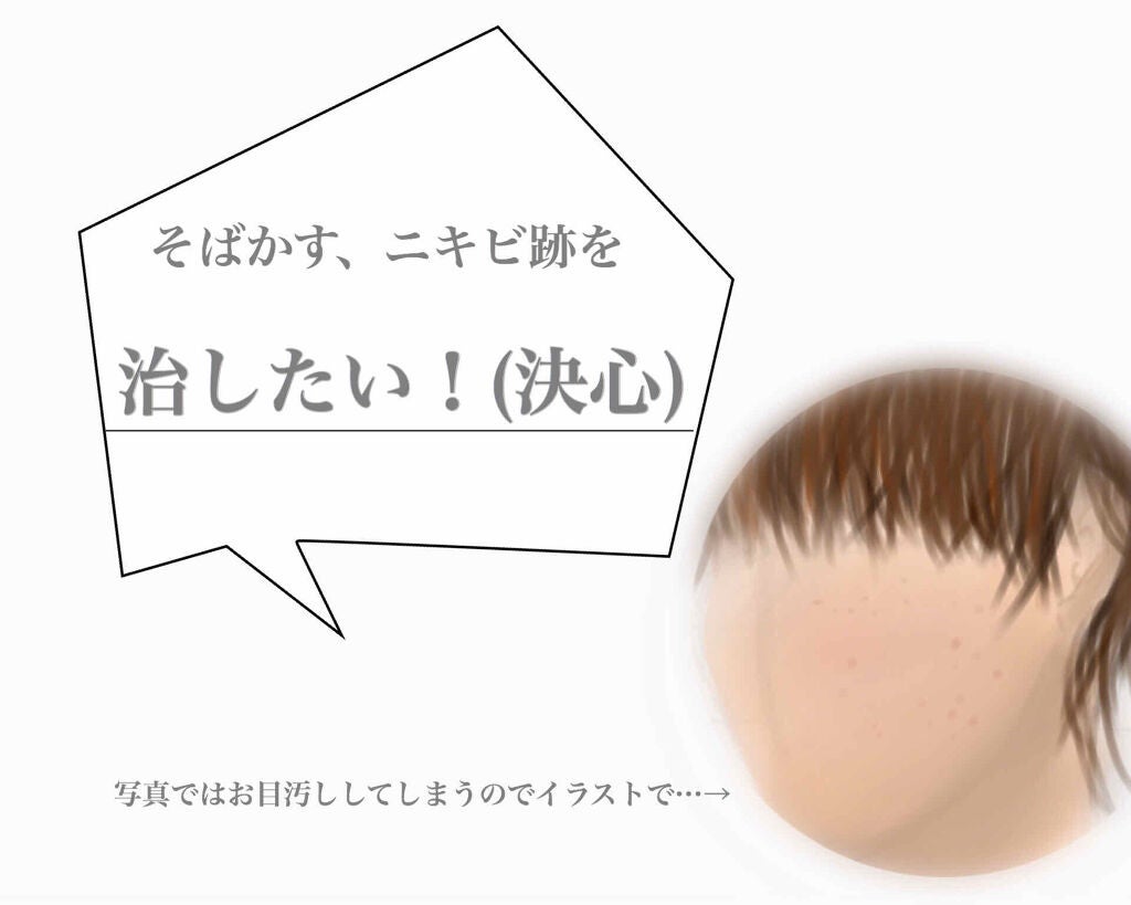 ハトムギローション/シンプルバランス/オールインワン化粧品を使ったクチコミ(1枚目)