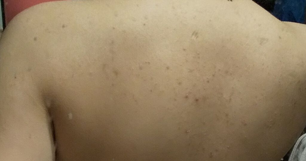 ãããð¹ on LIPS ãâ ïžé²èŠ§æ³šæ2æç®ã3æç®ã®åçã¯ãã³ã«ããšèäžã«ã§ããããã..ãïŒ3æç®ïŒ