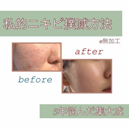 を使ったクチコミ(1枚目)