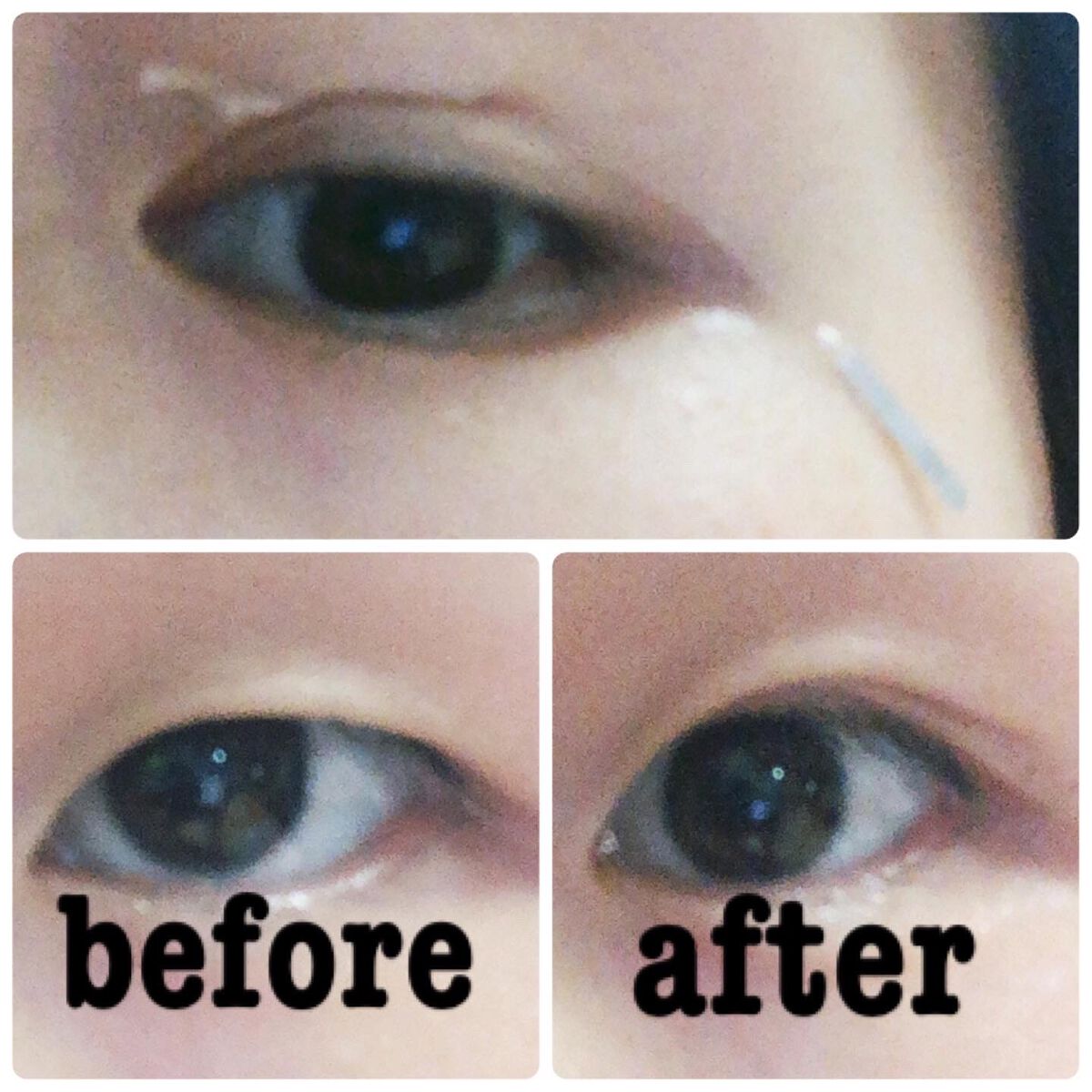 マイクロファイバー /ビー・エヌ/二重まぶた用アイテムを使ったクチコミ(4枚目)