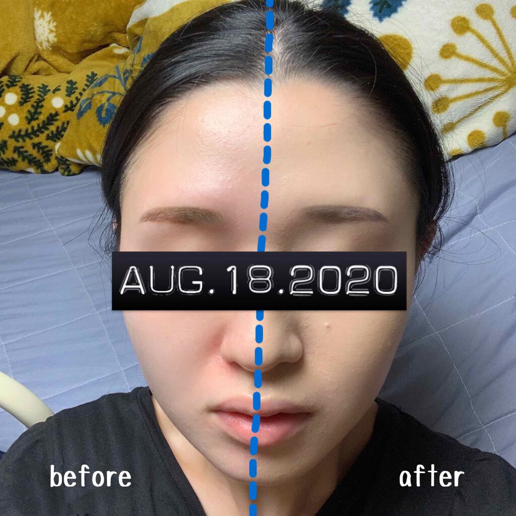 THE FIRST CUSHION COVER/MERZY/クッションファンデーションを使ったクチコミ(3枚目)