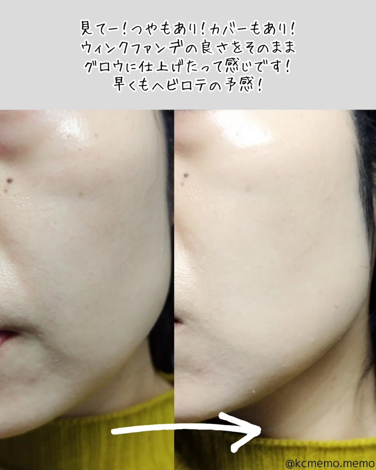 ジャビンドゥソウル ウインクファンデーションパクト/Javin De Seoul/クッションファンデーションを使ったクチコミ(7枚目)