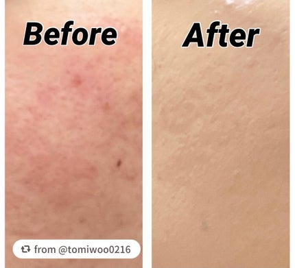 アンクル ド ポー ルクッションN/YVES SAINT LAURENT BEAUTE/クッションファンデーションを使ったクチコミ(2枚目)