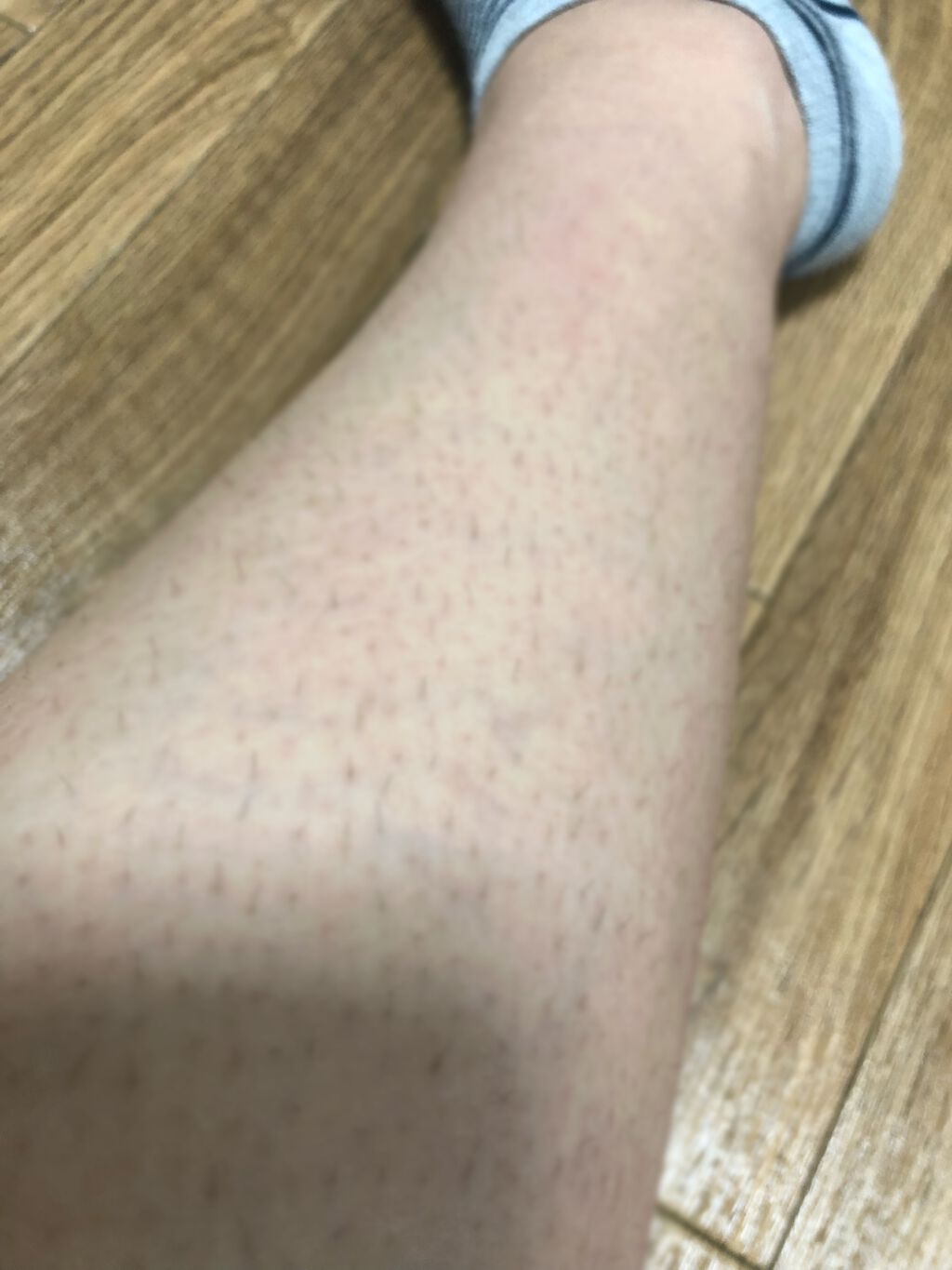 インバスリムーバー/LAXY BLAIR/除毛クリームを使ったクチコミ(5枚目)