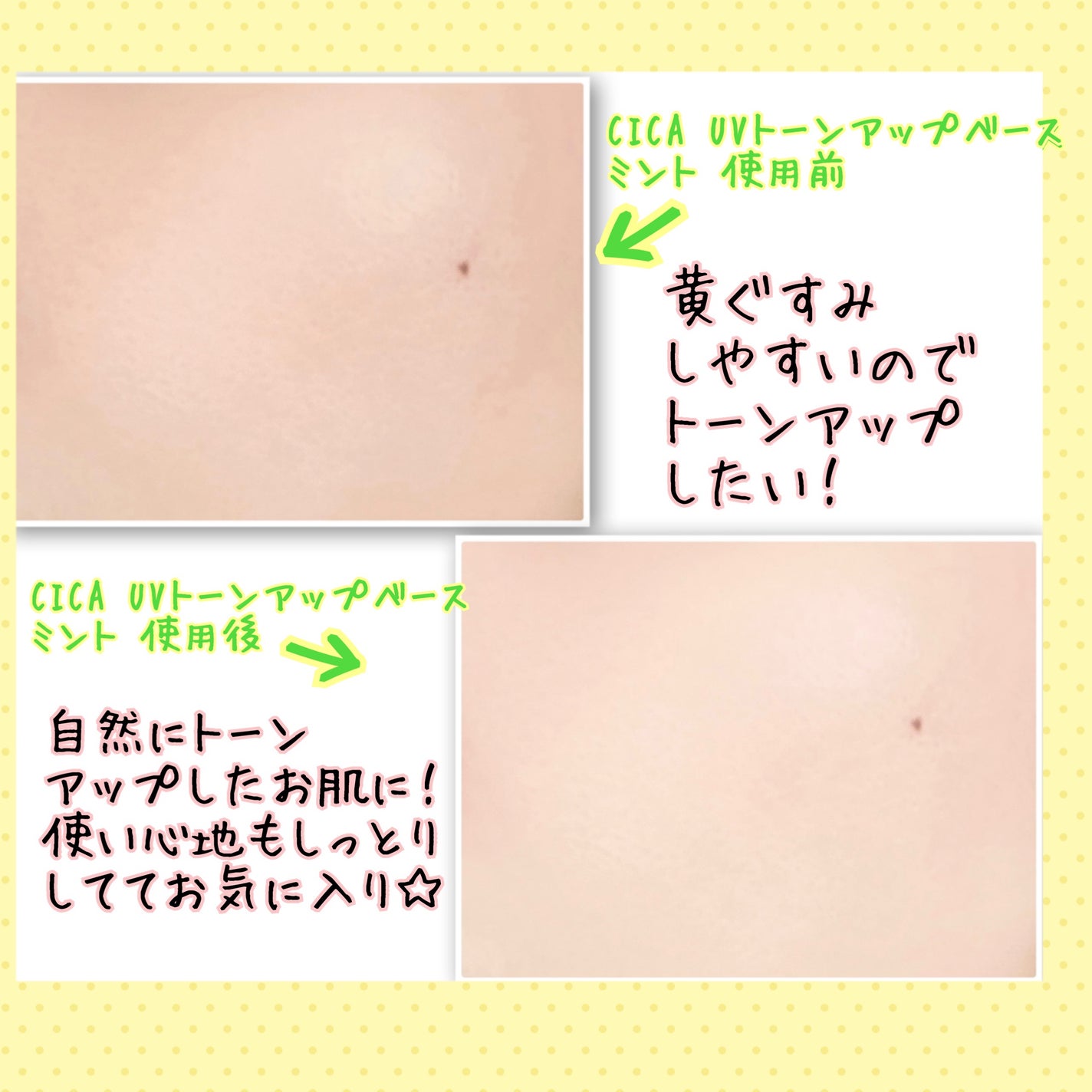 リードルショット100/VT/美容液を使ったクチコミ(7枚目)