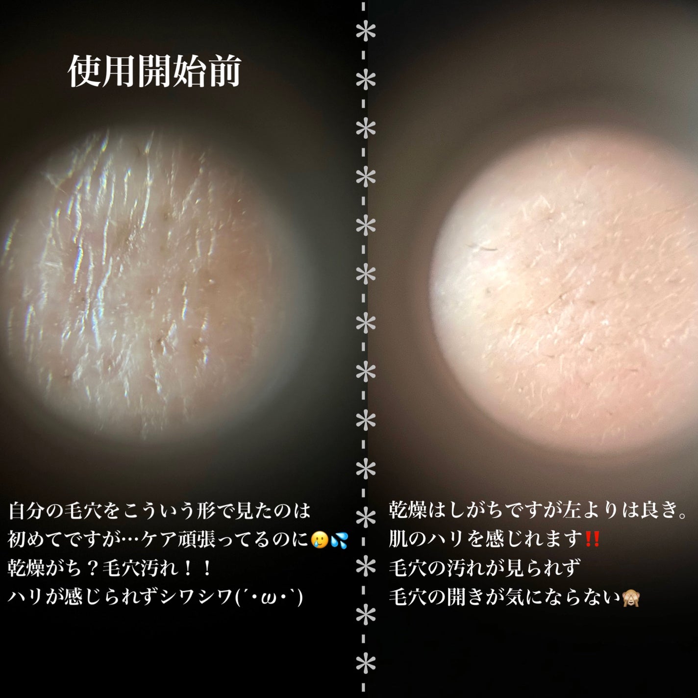 プロCICAリードルショット100/VT/ブースター・導入液を使ったクチコミ(6枚目)