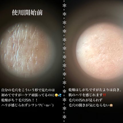 プロCICAリードルショット100/VT/ブースター・導入液を使ったクチコミ(6枚目)