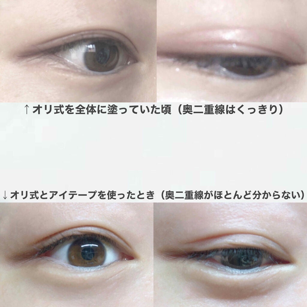 アイテープ(絆創膏タイプ、レギュラー、70枚)/DAISO/二重まぶた用アイテムを使ったクチコミ(6枚目)