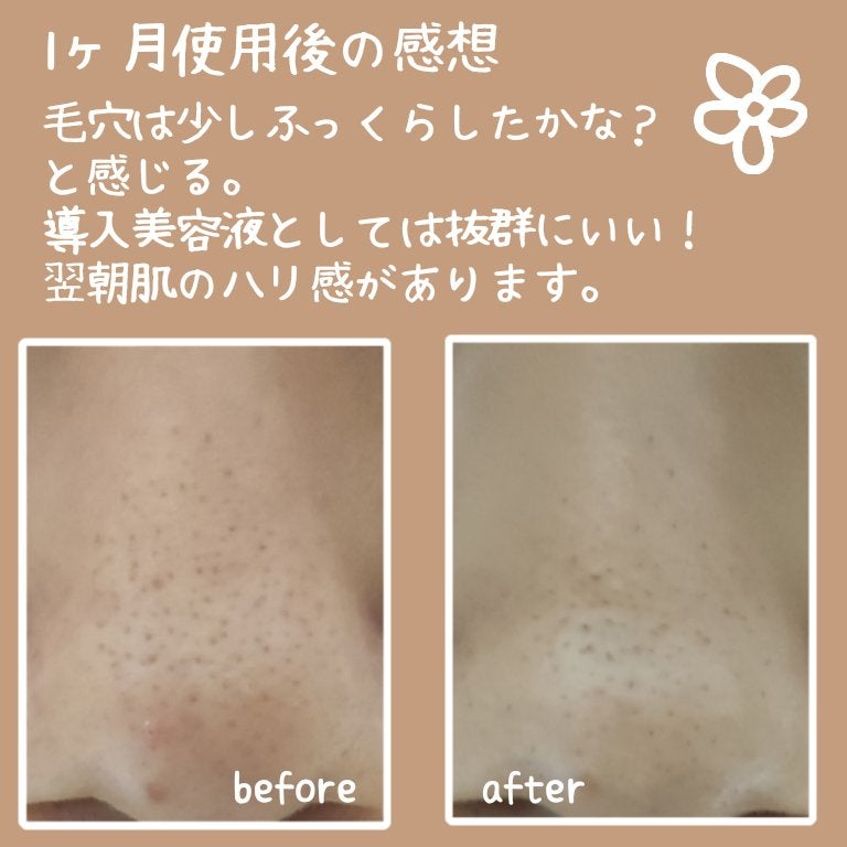 リードルショット300/VT/美容液を使ったクチコミ(3枚目)