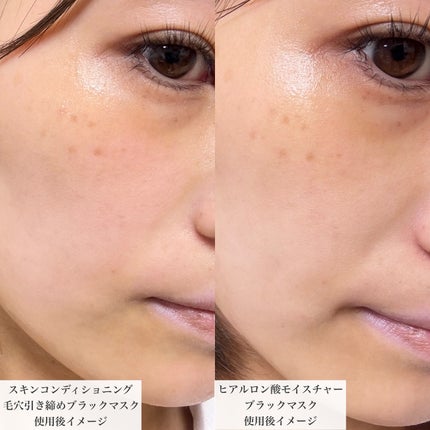 ヒアルロン酸モイスチャー ブラックマスク/我的心機/シートマスク・パックを使ったクチコミ(6枚目)