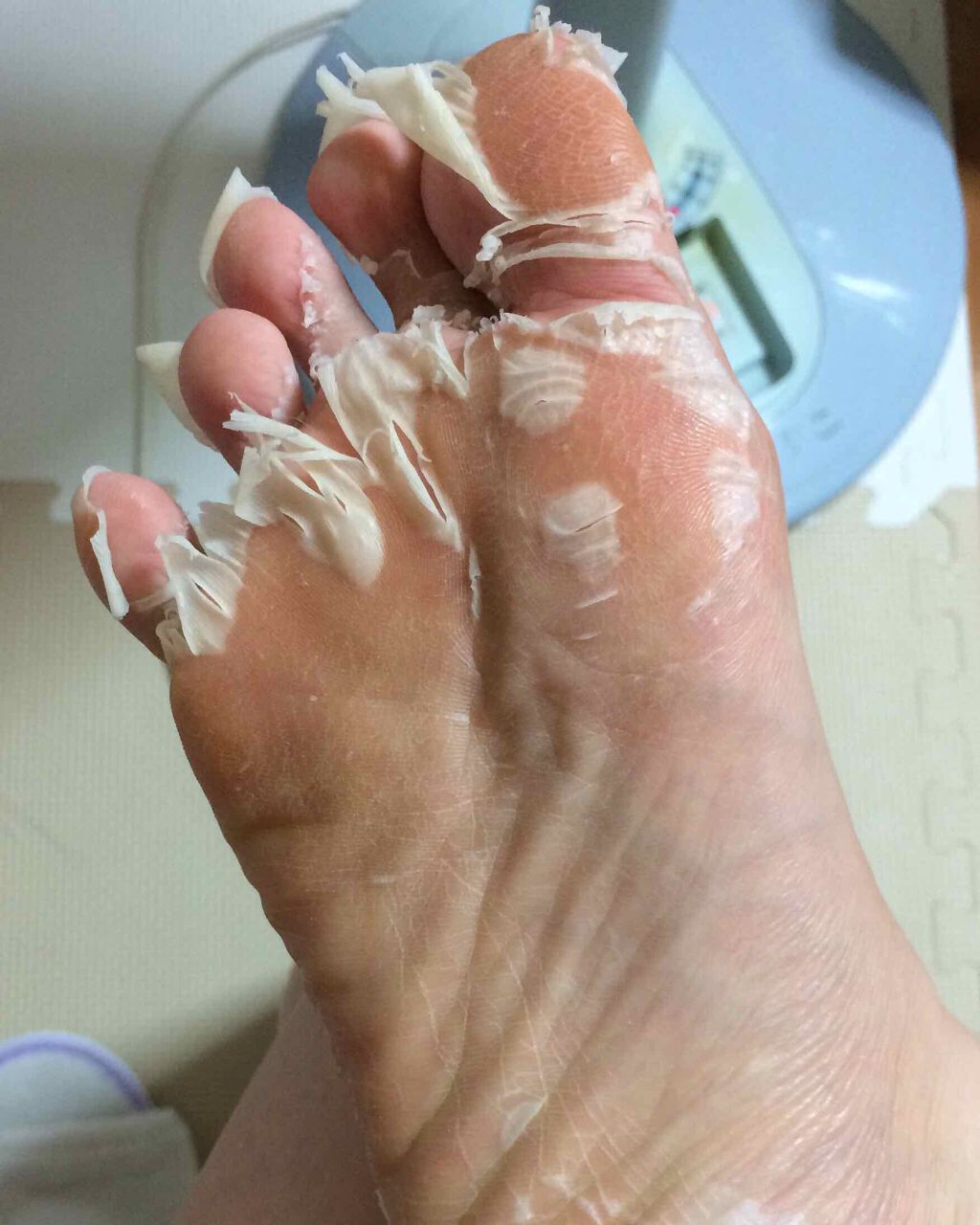 イージーパックDP60分タイプ/ベビーフット/レッグ・フットケアを使ったクチコミ(4枚目)