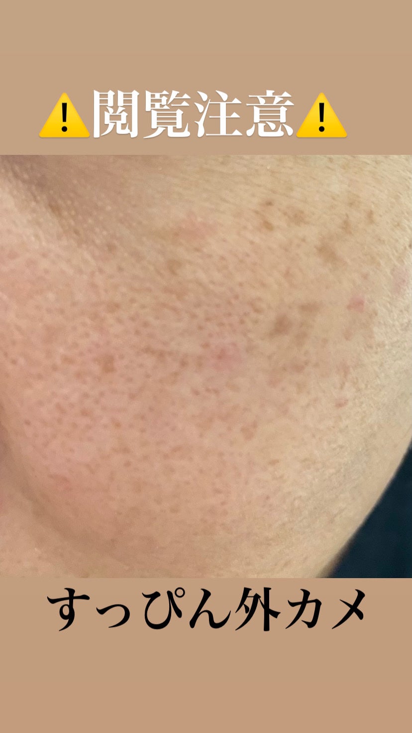 3D フェイス シェイプ パウダー/shu uemura/プレストパウダーを使ったクチコミ(2枚目)