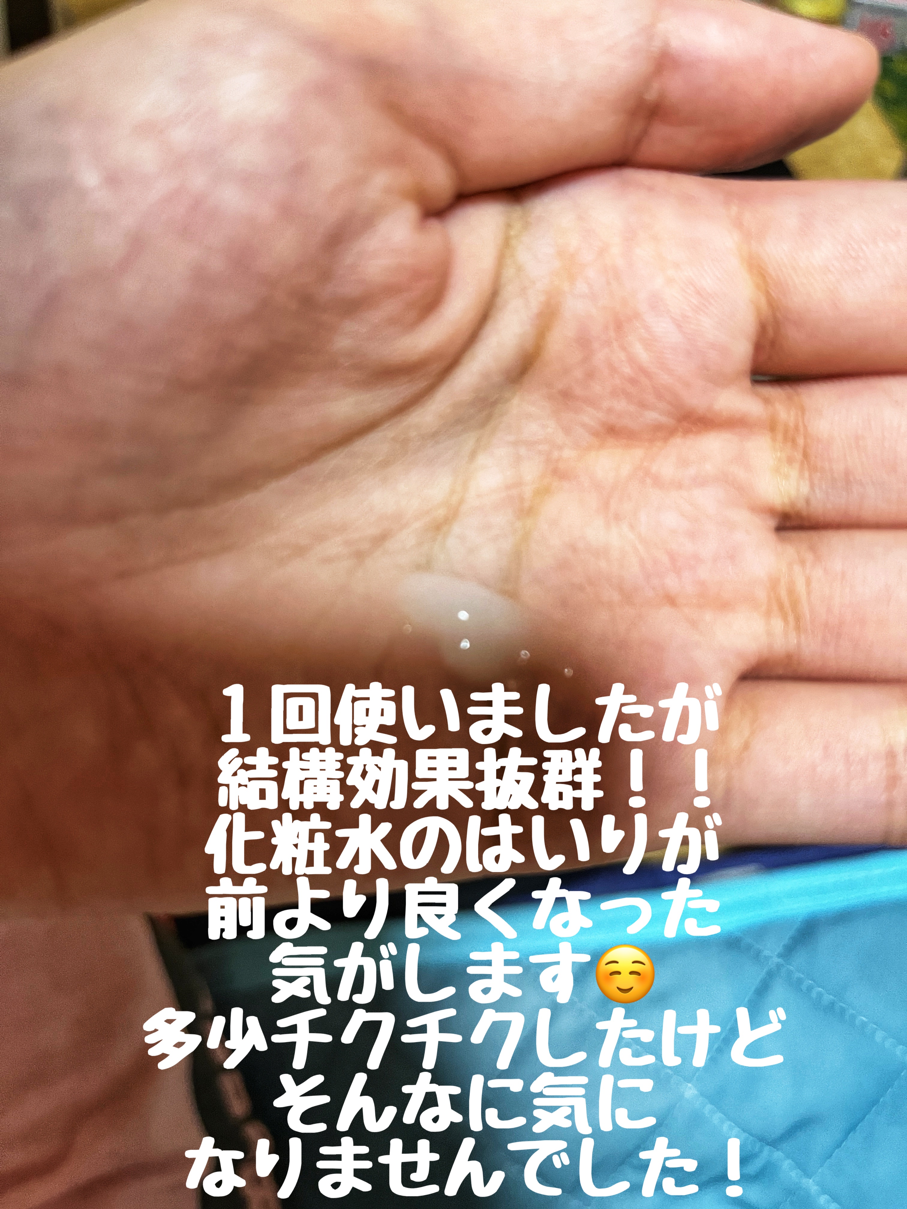 S300 リードル/VT/美容液を使ったクチコミ（3枚目）