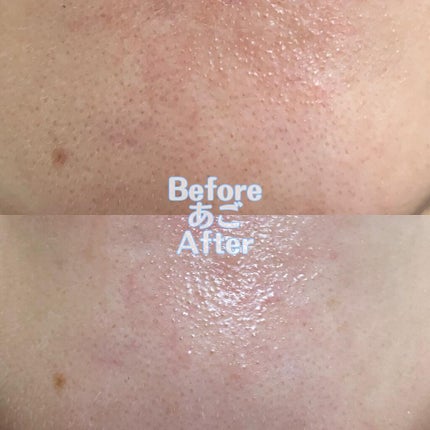 C25セラム ネオ/オバジ/美容液を使ったクチコミ(5枚目)