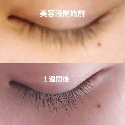 エグータム/アルマダスタイル/まつげ美容液を使ったクチコミ(1枚目)