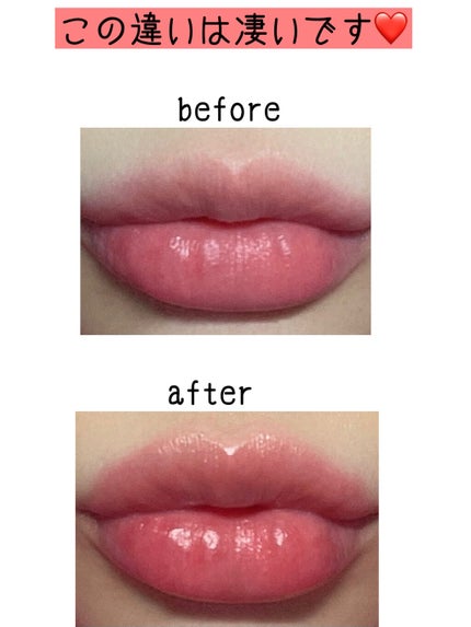 HOTOMI リッププランパー/HOTOMI/リッププランパーを使ったクチコミ(4枚目)