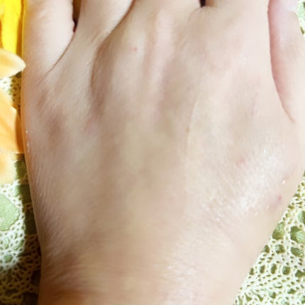 タカミスキンピール/タカミ/ブースター・導入液を使ったクチコミ(4枚目)