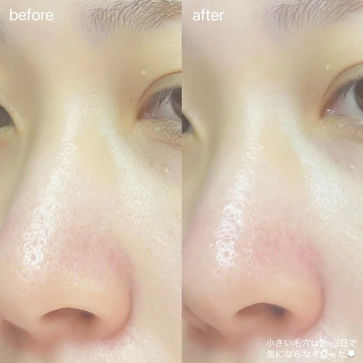 ポアタイトニングブーストセラム/CELORABY/美容液を使ったクチコミ(2枚目)