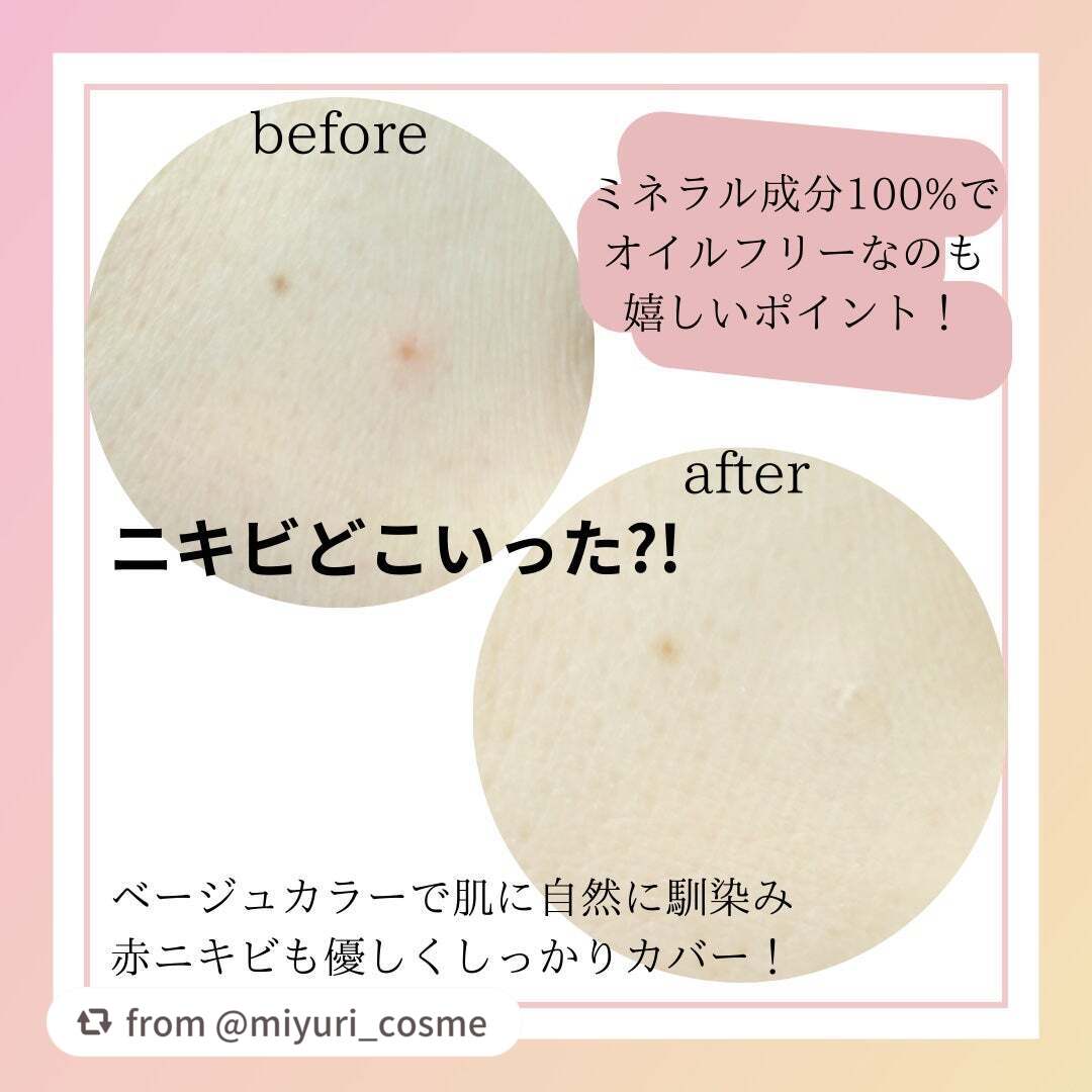 薬用コンシーラー アクネプロテクター/ONLY MINERALS/パウダーコンシーラーを使ったクチコミ(4枚目)