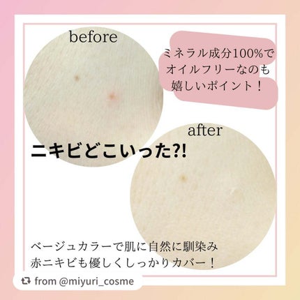 薬用コンシーラー アクネプロテクター/ONLY MINERALS/パウダーコンシーラーを使ったクチコミ(4枚目)