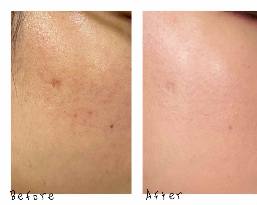 ノーセバム ミネラルパウダー/innisfree/ルースパウダーを使ったクチコミ(2枚目)