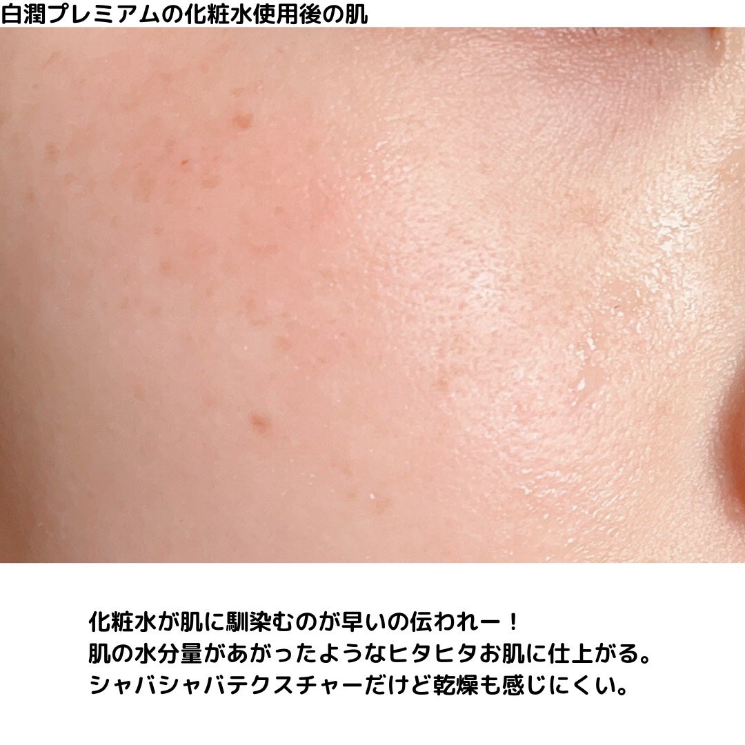 白潤プレミアム薬用浸透美白化粧水/肌ラボ/化粧水を使ったクチコミ(5枚目)