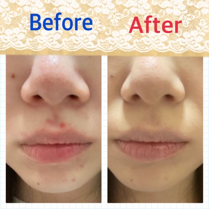 ドクタージャルト シカペア リカバー (第2世代)/Dr.Jart+/フェイスクリームを使ったクチコミ(5枚目)