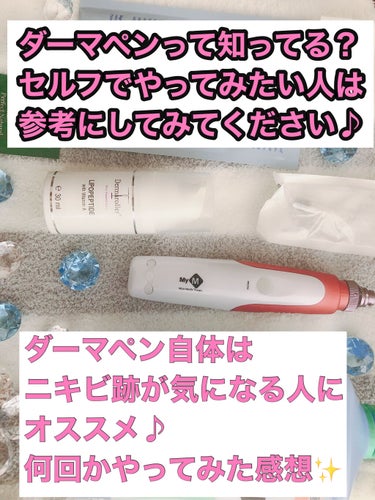 消毒用エタノール(医薬品)/健栄製薬/その他を使ったクチコミ（1枚目）