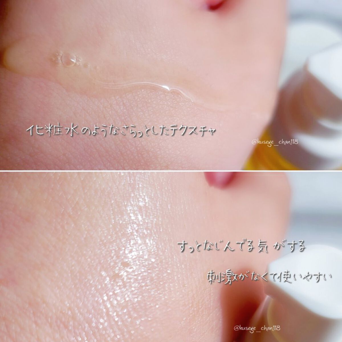 V エッセンス/unlabel/美容液を使ったクチコミ（3枚目）