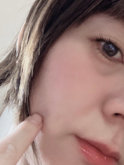 極薄透明パッチ nikipa!/金冠堂/にきびパッチを使ったクチコミ(3枚目)