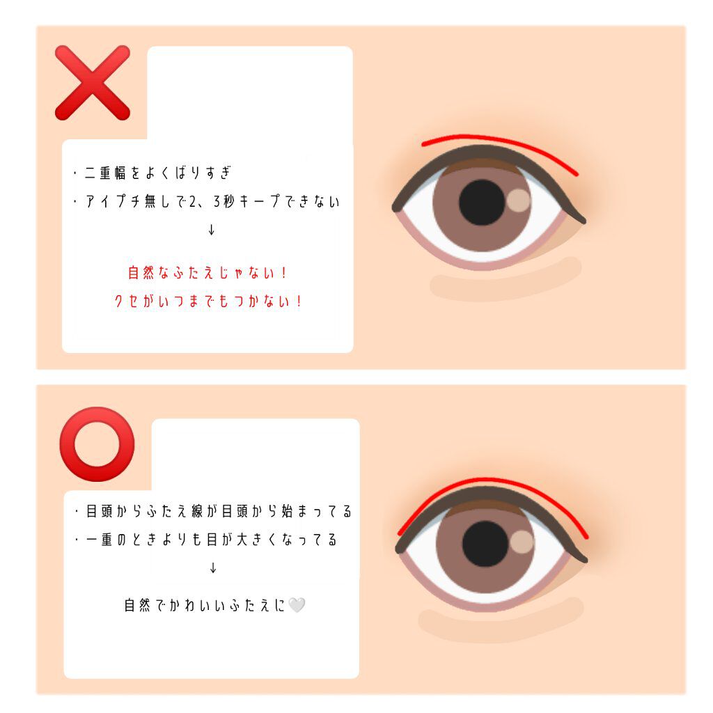 のびーるアイテープ（絆創膏タイプ、レギュラー）/DAISO/二重まぶた用アイテムを使ったクチコミ（2枚目）