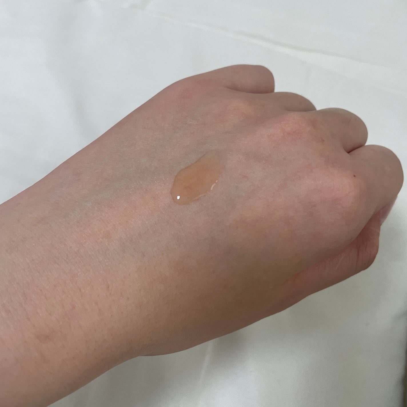 RXザ・アルファアルブチン2 ニキビ跡ケアセラム/COSRX/美容液を使ったクチコミ(4枚目)