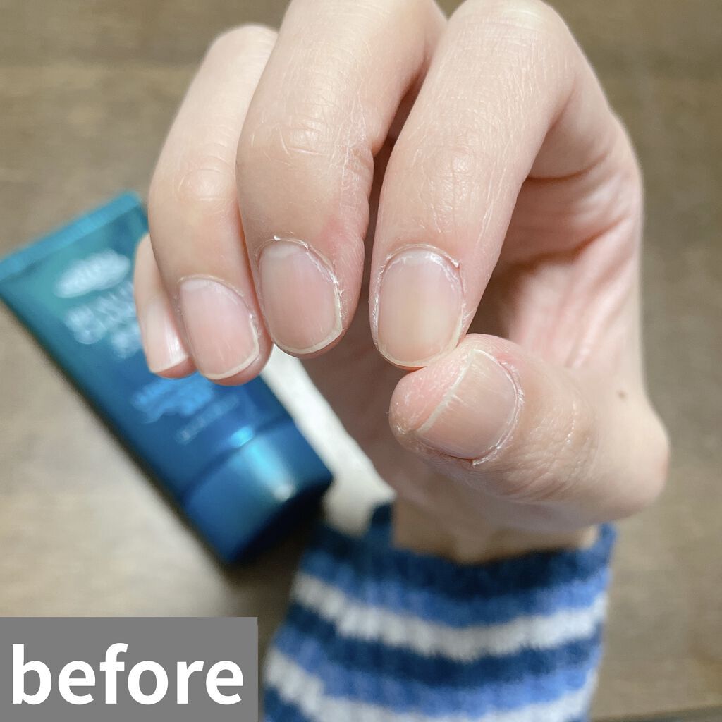 ビューティーチャージ 無香料/アトリックス/ハンドクリームを使ったクチコミ（2枚目）