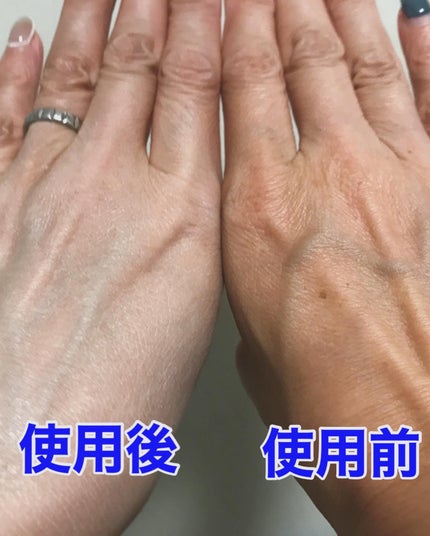 薬用ホワイトコンク ホワイトニングCC CII/ホワイトコンク/ボディクリームを使ったクチコミ(7枚目)