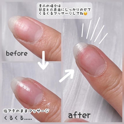 ネイルジェルオイル/スキューズミー/ネイルオイル・トリートメントを使ったクチコミ(8枚目)