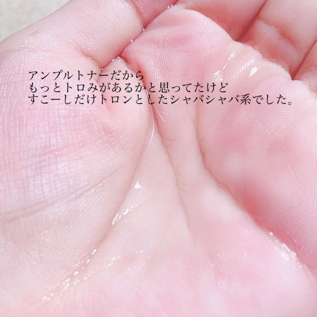 ビフィダバイオームアンプルトナー/manyo/化粧水を使ったクチコミ(2枚目)