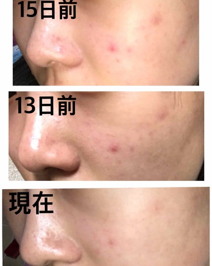 ハトムギ化粧水(ナチュリエ スキンコンディショナー R )/ナチュリエ/化粧水を使ったクチコミ(3枚目)