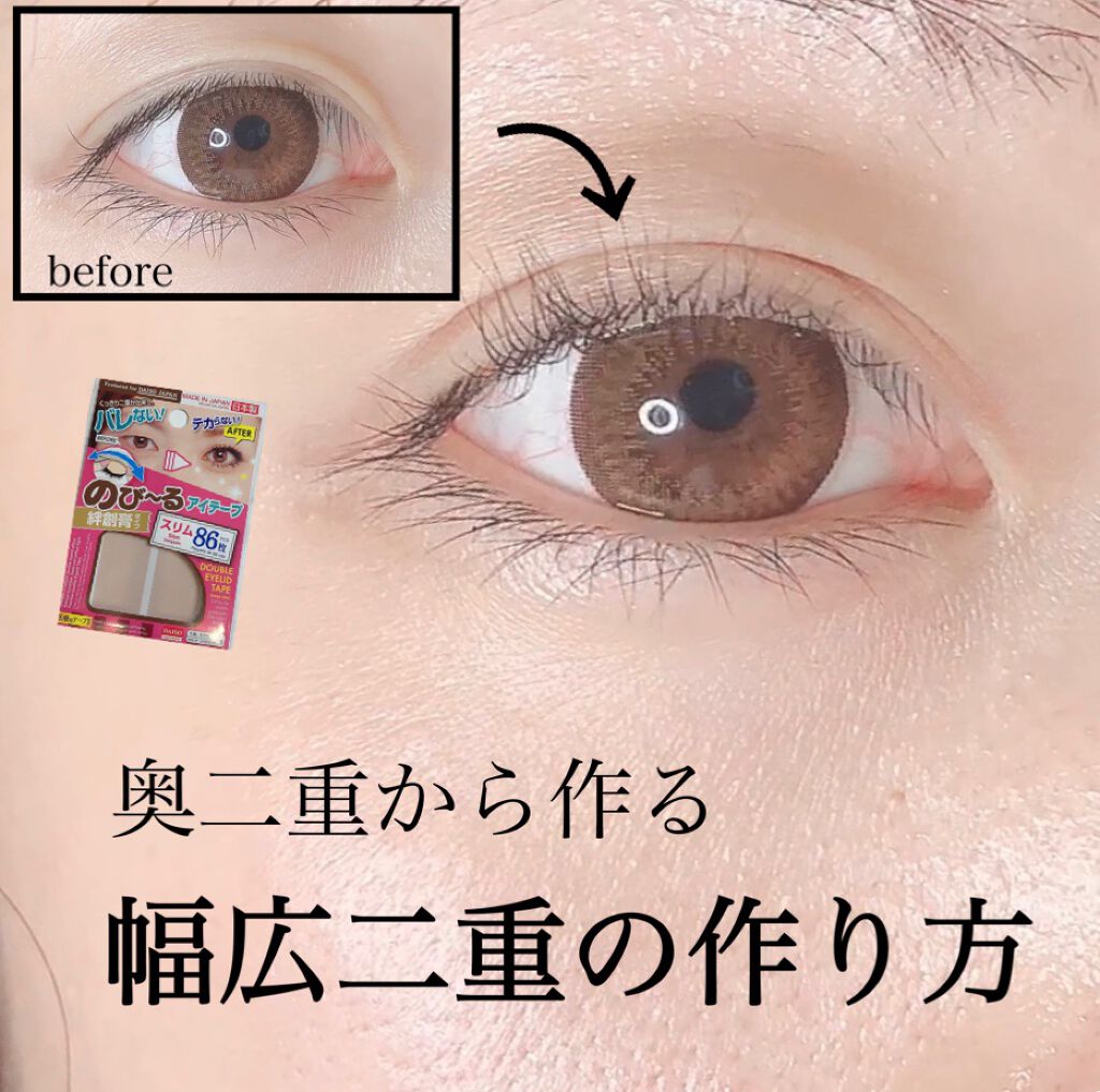 アイテープ(絆創膏タイプ、レギュラー、70枚)/DAISO/二重まぶた用アイテムを使ったクチコミ(1枚目)