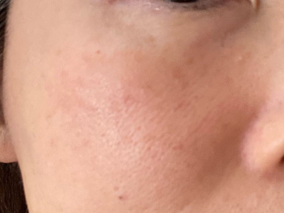 リペアジェル/リソウコーポレーション/美容液を使ったクチコミ(7枚目)